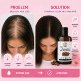 Black Castor Oil For Hair Growth Treatment