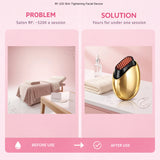 RF LED Skin Tightening Facial Device