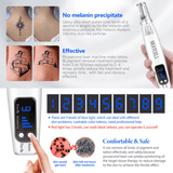 tattoo removal