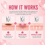 Picosecond Plasma Pen for Dark Spots, Freckles & Pigmentation