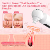 Electric Blackhead Remover Pore Cleaner For Deep Cleansing And Hot Compress