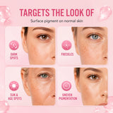 Picosecond Plasma Pen for Dark Spots, Freckles & Pigmentation