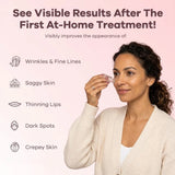 Micro Infusion Anti-Aging Kit Salon Results at Home