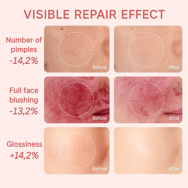 LED Face Mask for Face Advanced Skin Care