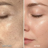 Micro Infusion Anti-Aging Kit Salon Results at Home