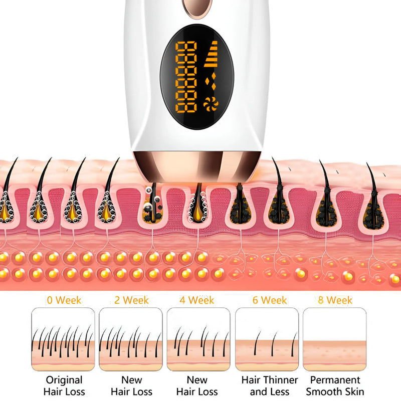 Hair Removal Machine 